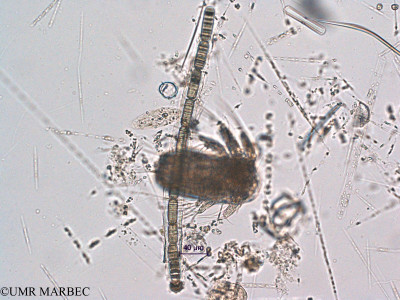 phyto/Scattered_Islands/all/COMMA April 2011/Katagnymene sp (1)(copy)_thumb.jpg